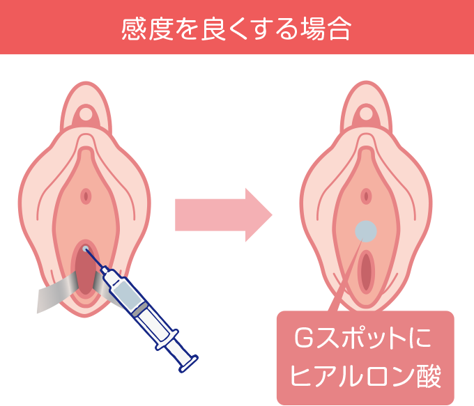 感度を良くする場合の画像